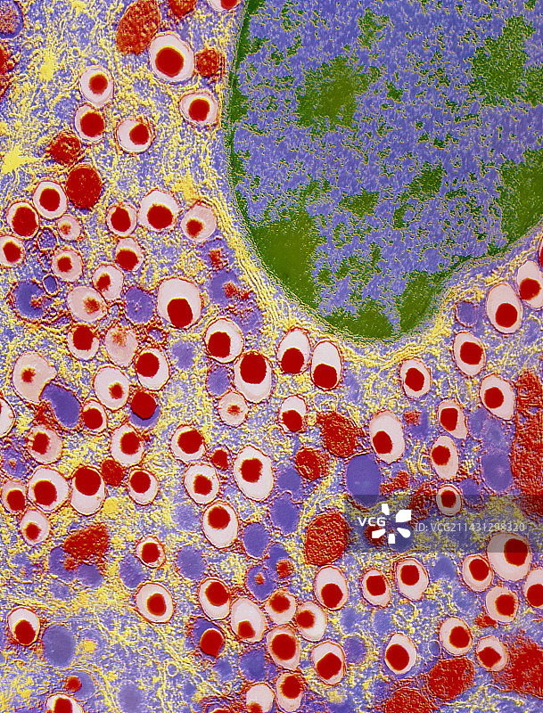 彩色胰岛细胞TEM图图片素材