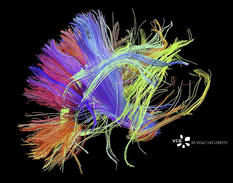 人脑的白质纤维图片素材