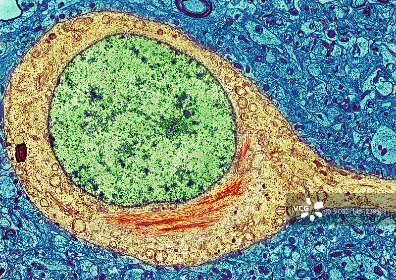 阿尔茨海默病脑细胞（TEM）图片素材