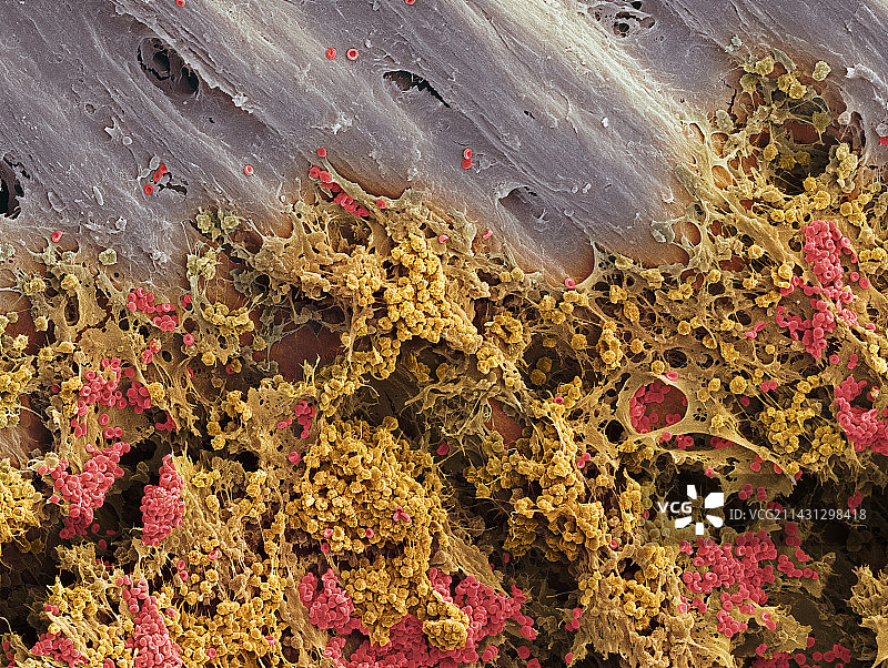 骨髓扫描电镜图图片素材