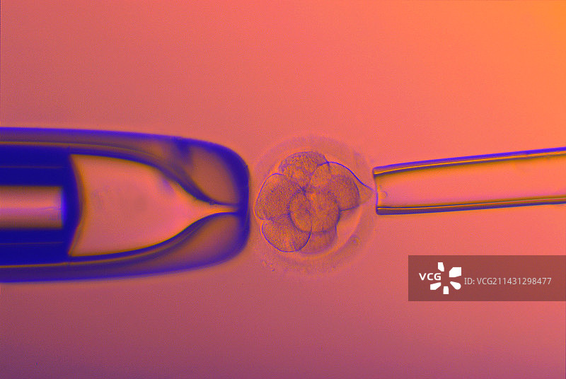 试管婴儿胚胎检测图片素材