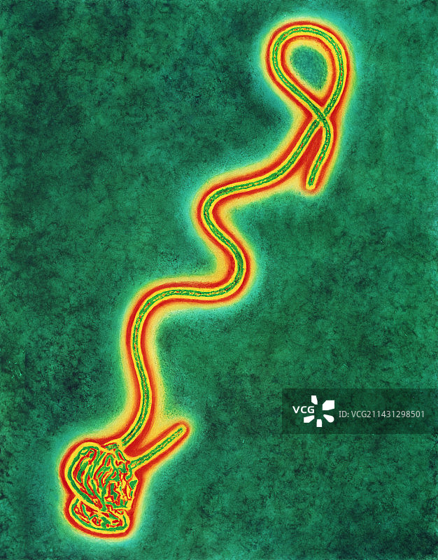埃博拉病毒的透射电子显微镜照片图片素材