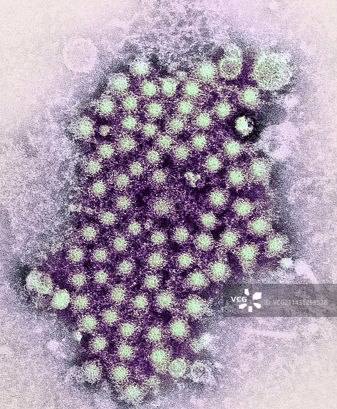 肝炎病毒颗粒（透射电镜）图片素材