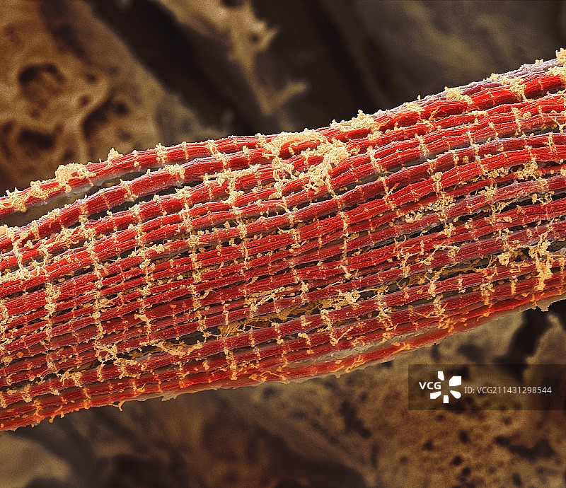 骨骼肌纤维，扫描电子显微镜图片素材