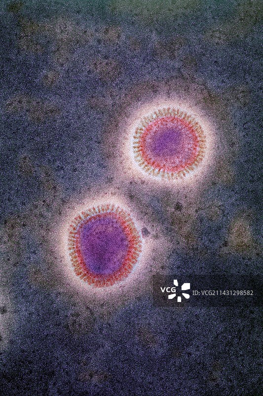 流感病毒，TEM图片素材
