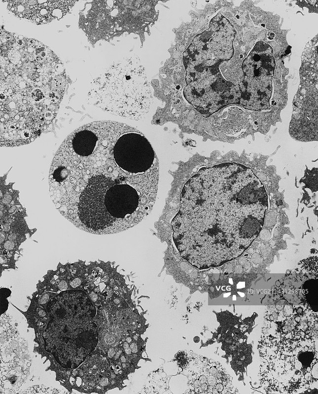 细胞凋亡期间的髓系白细胞的透射电镜照片图片素材