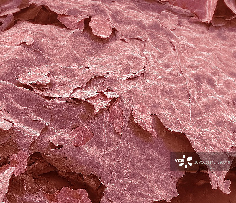 晒伤皮肤扫描电镜图图片素材