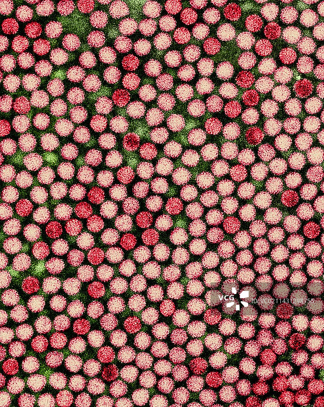 乙型肝炎病毒（透射电子显微镜）图片素材