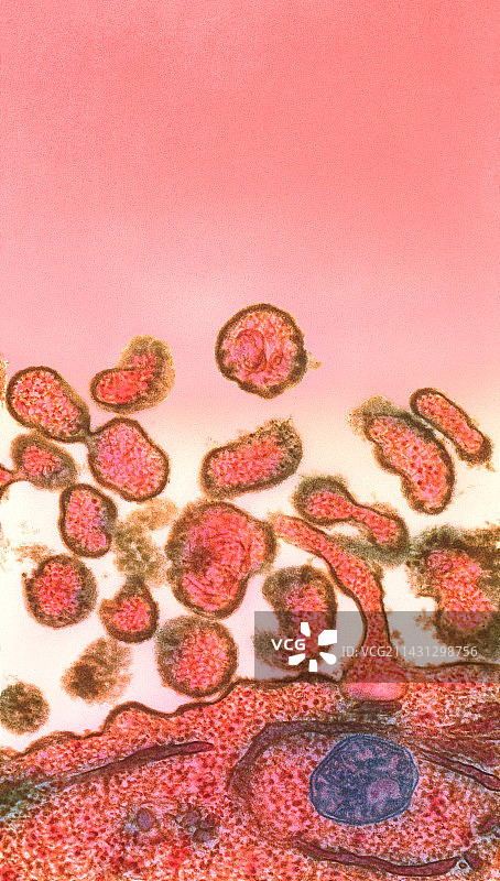 麻疹病毒（TEM）图片素材