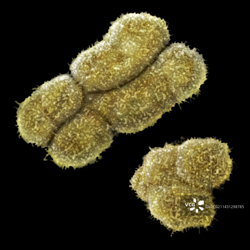 男性人类性染色体X和Y的扫描电镜图图片素材