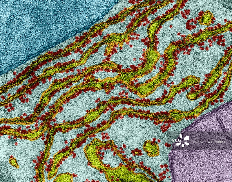 粗糙的内质网和核糖体，TEM图片素材