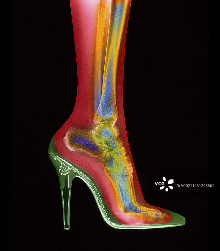高跟鞋里的脚图片素材