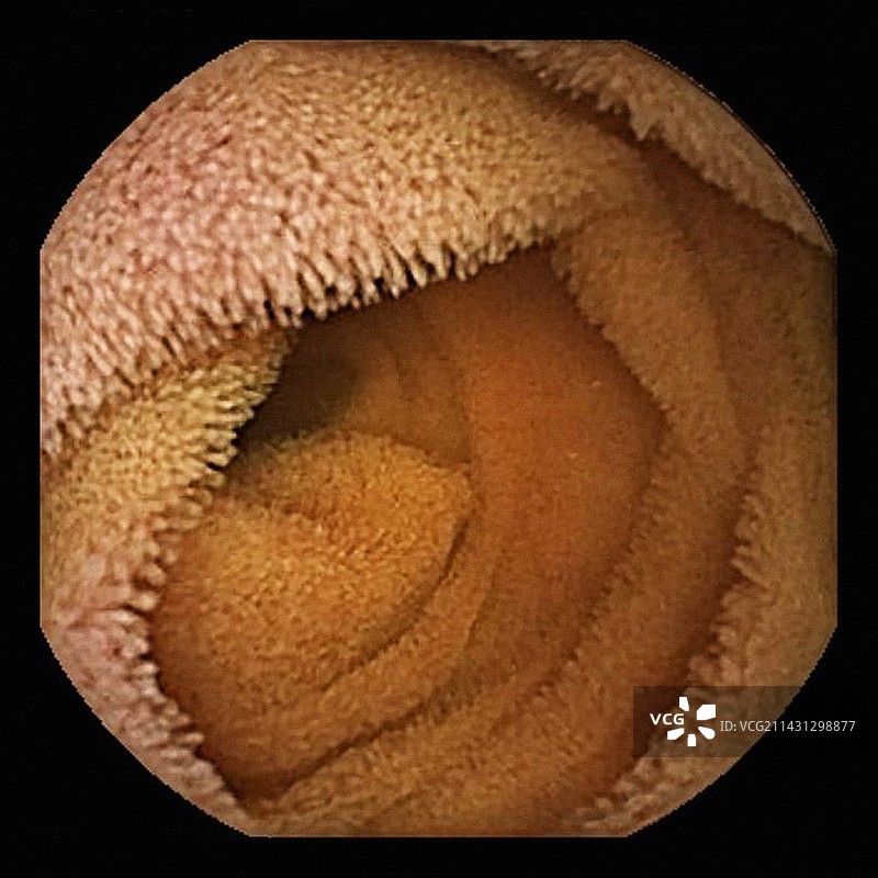小肠内窥镜视图图片素材