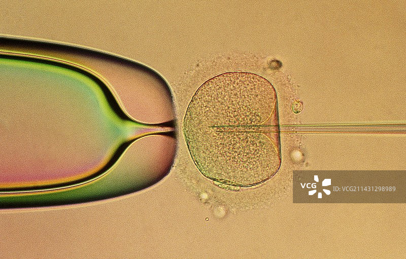 试管婴儿：卵子被注入精子DNA图片素材