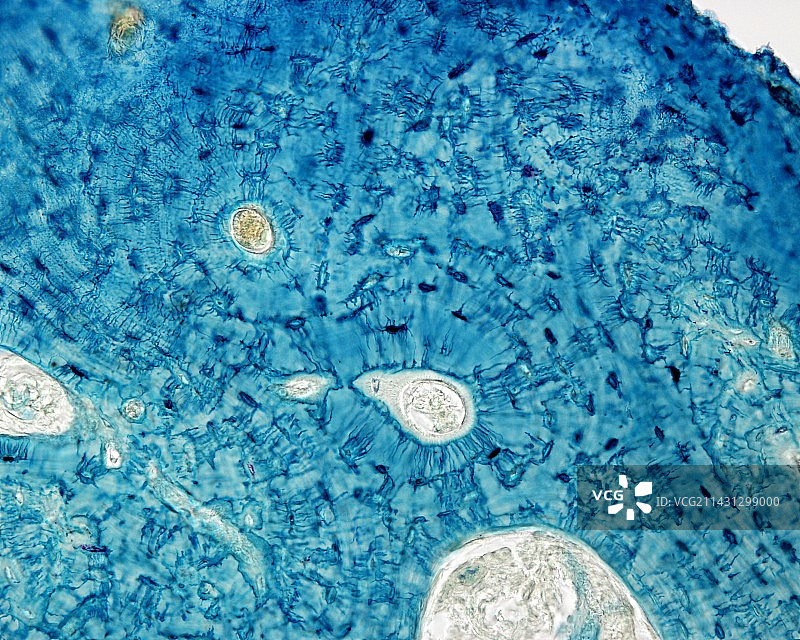 骨密质骨单位，光学显微照片图片素材