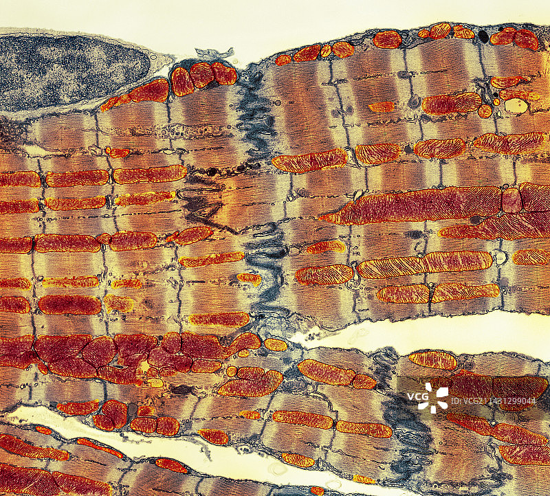 心肌组织TEM图片素材