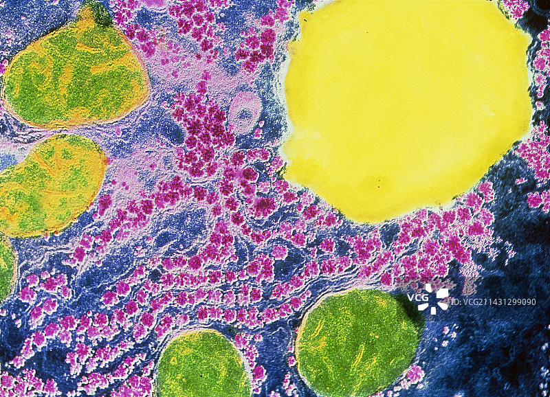 肝细胞切片的伪彩色透射电镜图图片素材