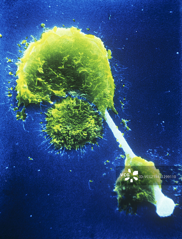 巨噬细胞刺穿石棉针的扫描电镜图图片素材