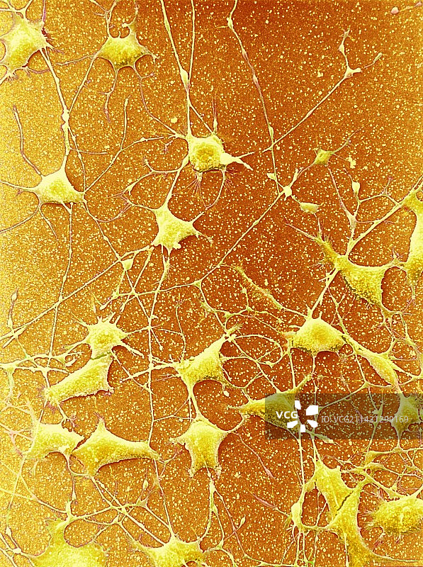 神经细胞扫描电镜图图片素材