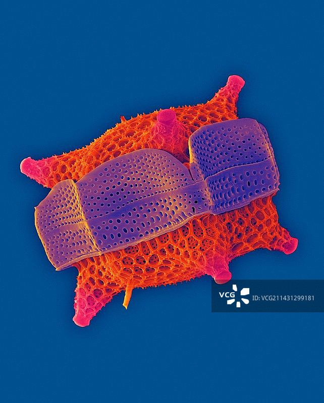 杜比亚三角藻，扫描电子显微镜图片素材