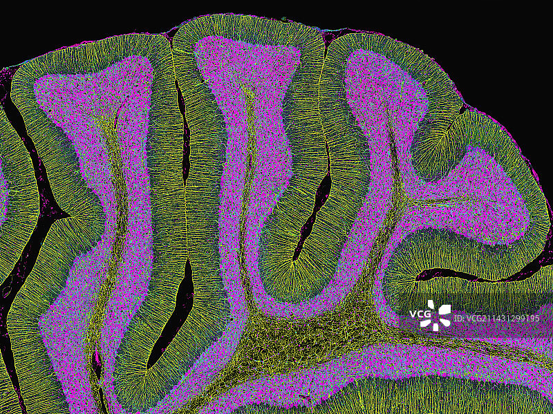 大脑小脑显微照片图片素材
