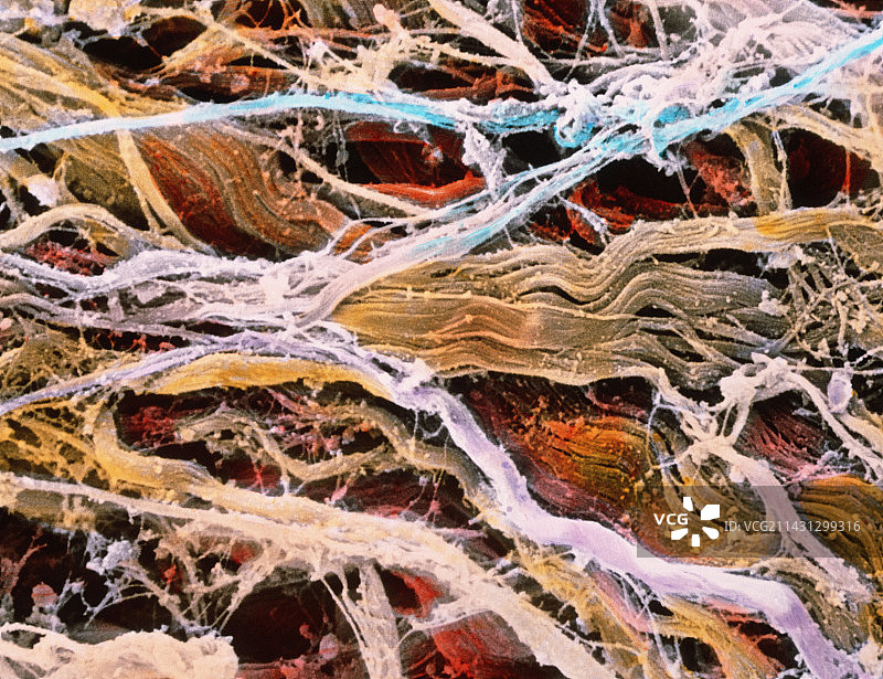 结缔组织束的伪彩色扫描电镜图图片素材