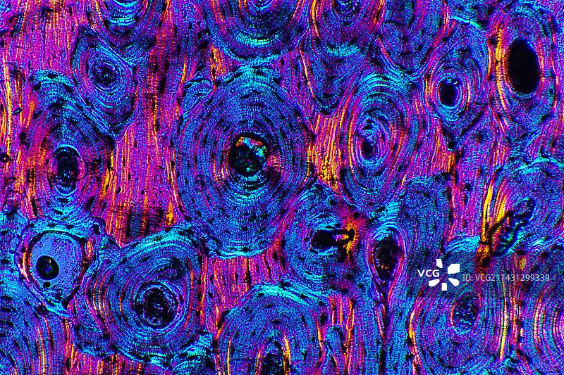 骨骼结构显微照片图片素材