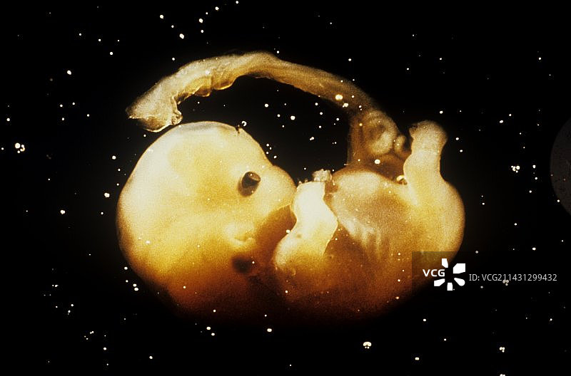 7周大的人类胚胎图片素材