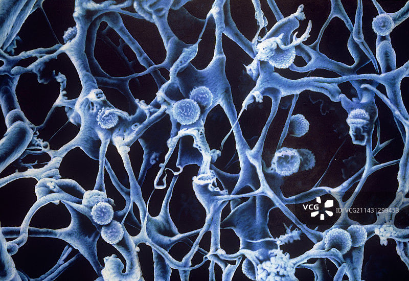 人体淋巴结切面插画图片素材