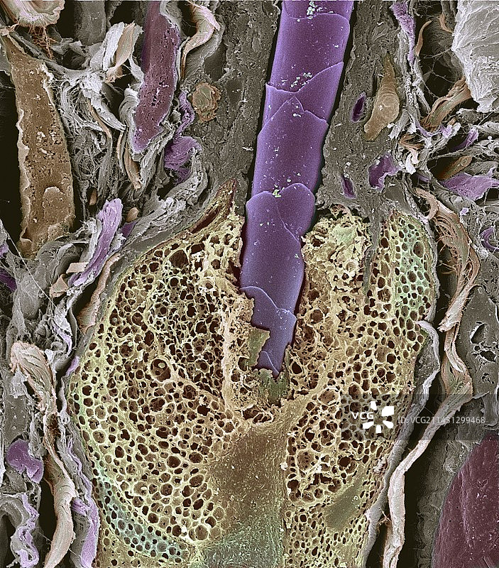 毛囊，扫描电子显微镜图片素材