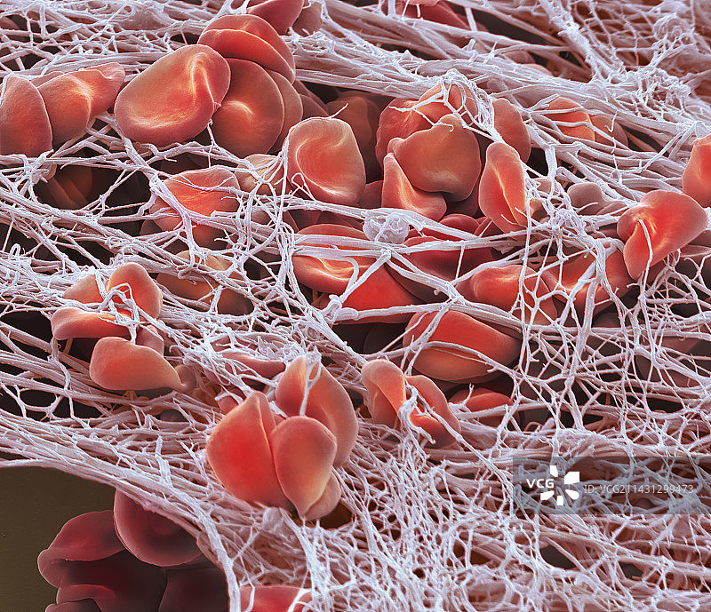 血栓扫描电镜图片素材