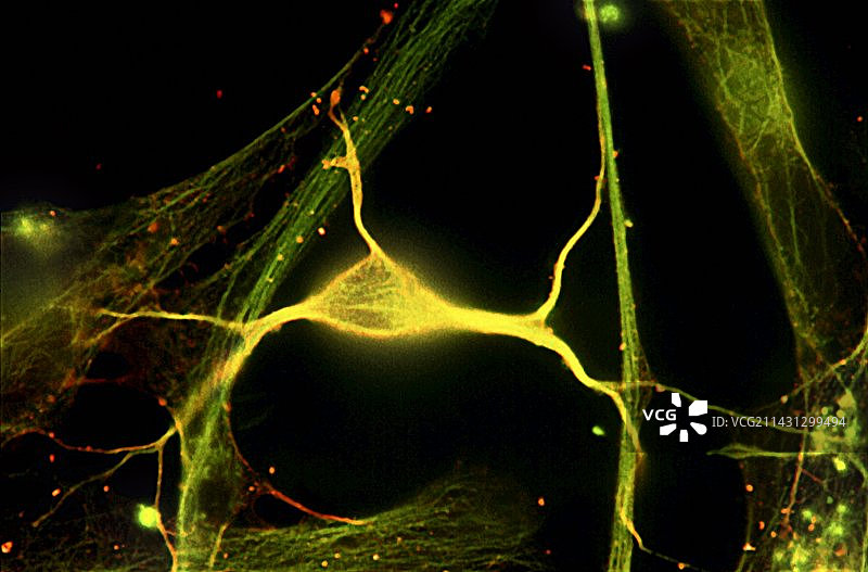 海马神经元荧光显微照片图片素材