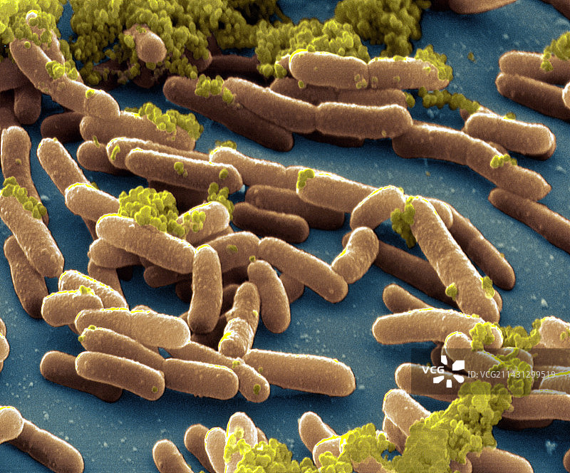 鼠伤寒沙门氏菌的扫描电镜图图片素材