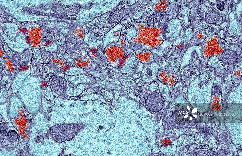 脑突触，透射电镜图片素材