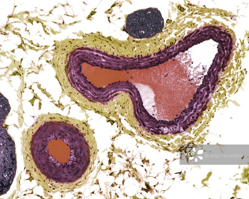 血管显微照片图片素材