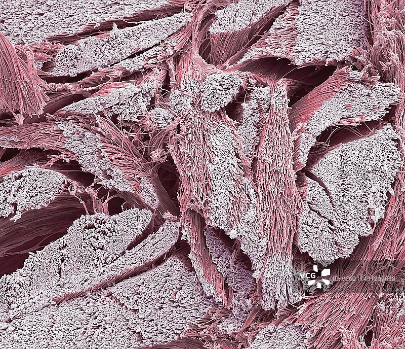 胶原纤维扫描电镜图图片素材