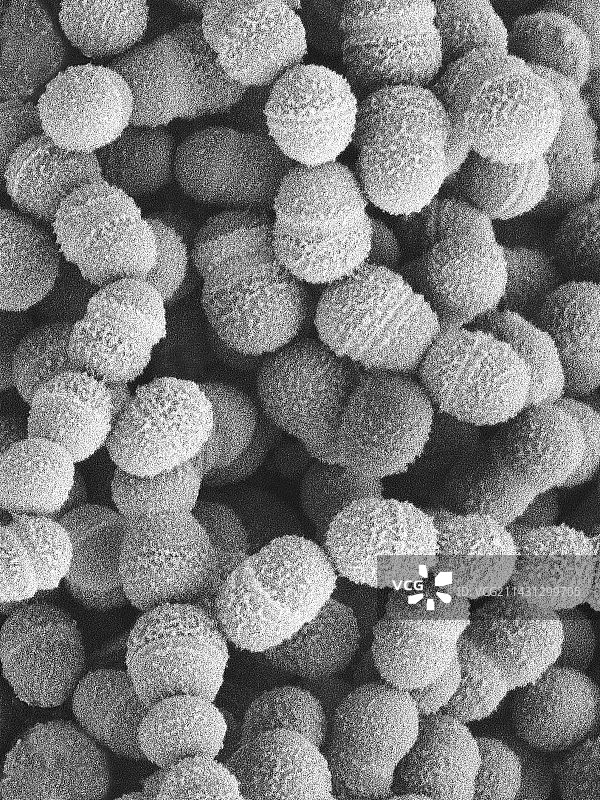 唾液链球菌扫描电镜图图片素材