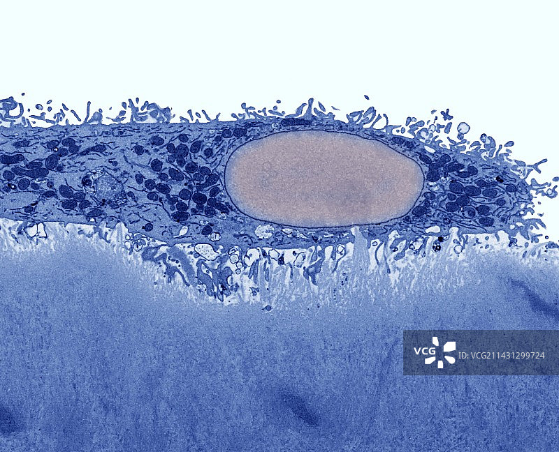 牙质上的破骨细胞（透射电子显微镜）图片素材