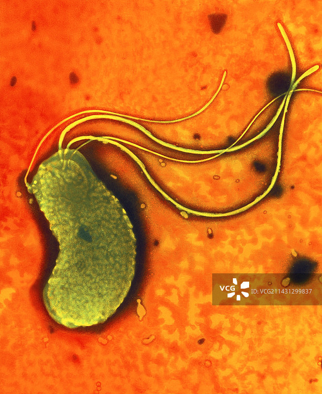 幽门螺杆菌图片素材