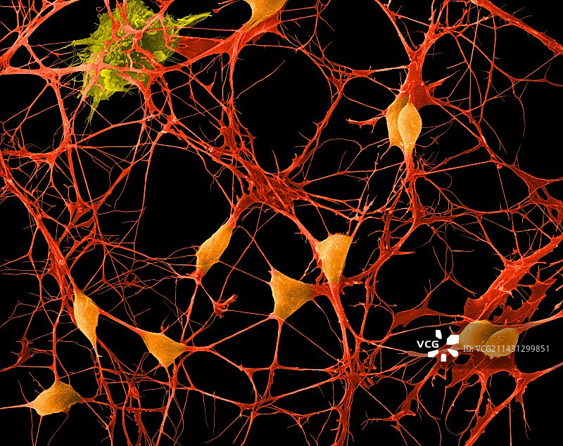 皮质神经元扫描电镜图片素材