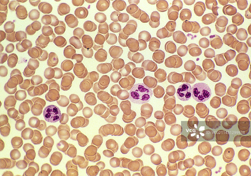 显示红细胞和白细胞的人血涂片的光学显微镜照片图片素材