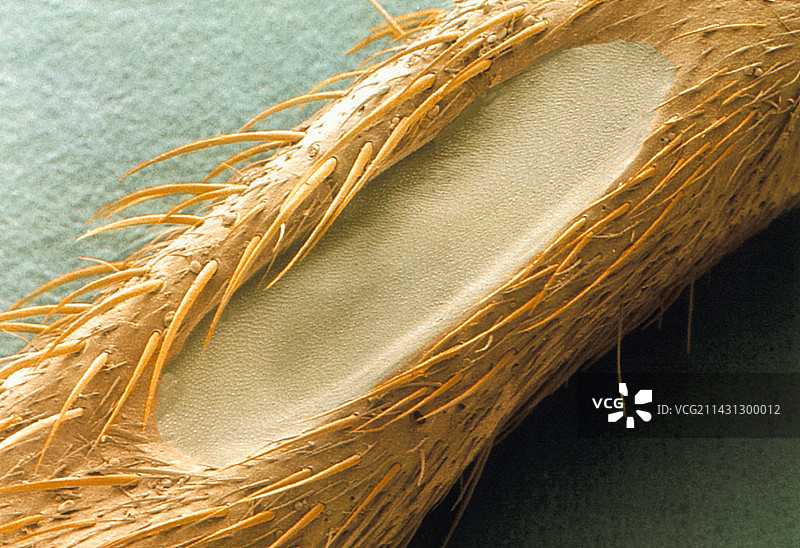 板球听觉器官扫描电镜图图片素材