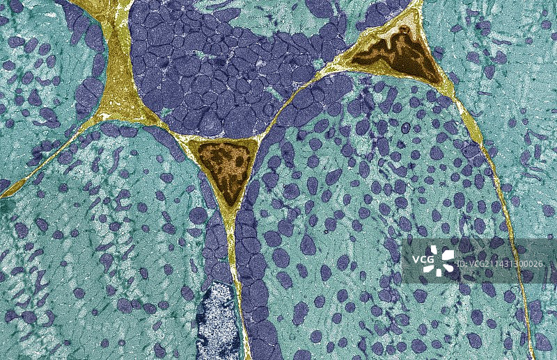 横纹肌，TEM图片素材