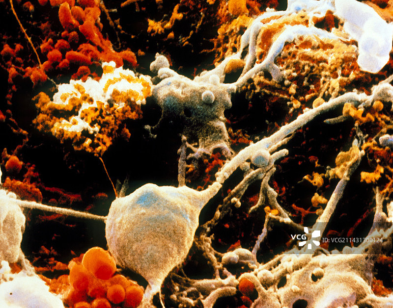 神经元和神经胶质细胞的扫描电镜图图片素材