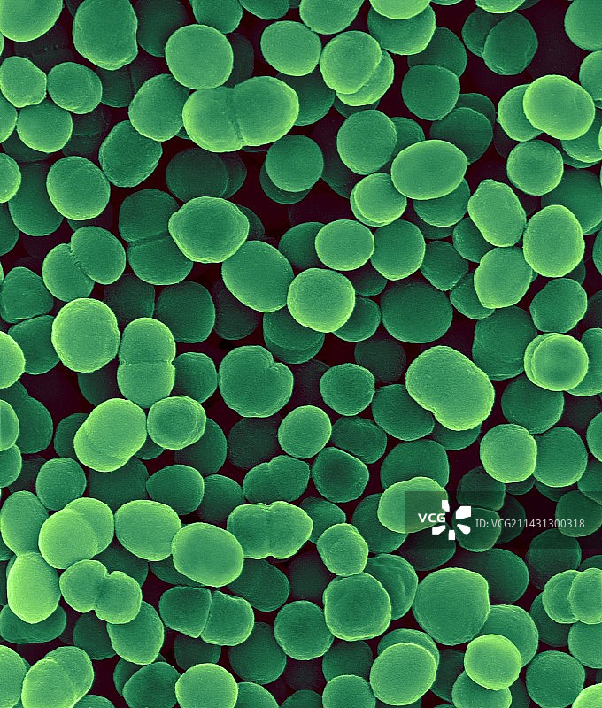 卡他莫拉克斯菌，双球菌，扫描电子显微镜图片素材