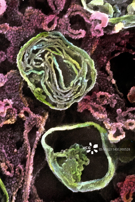 胰腺细胞中溶酶体扫描电镜照片图片素材