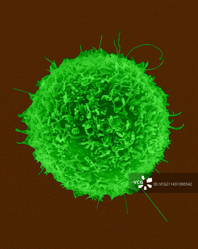 人T淋巴细胞，扫描电子显微镜图片素材