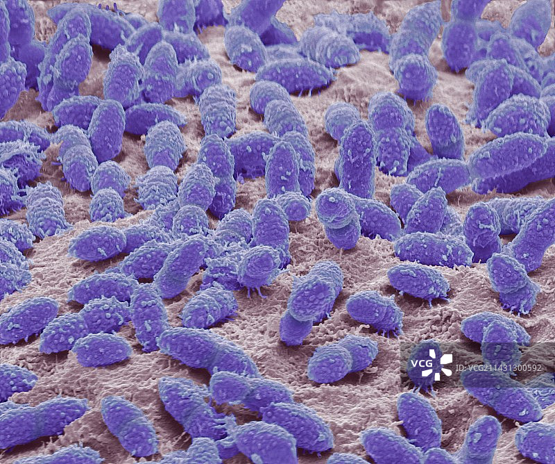 粪便细菌扫描电镜图图片素材