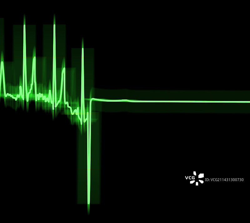 心电图轨迹图片素材