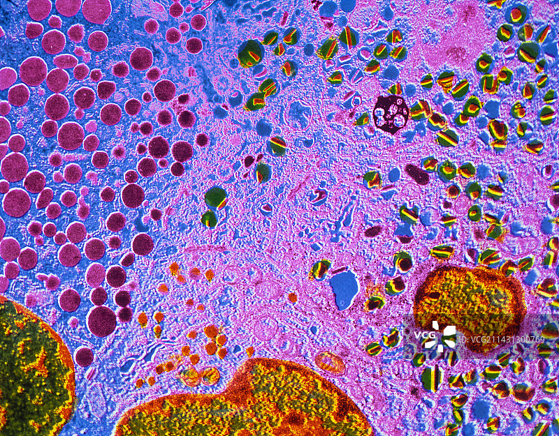 显示朗格汉斯细胞的伪彩色透射电镜图图片素材